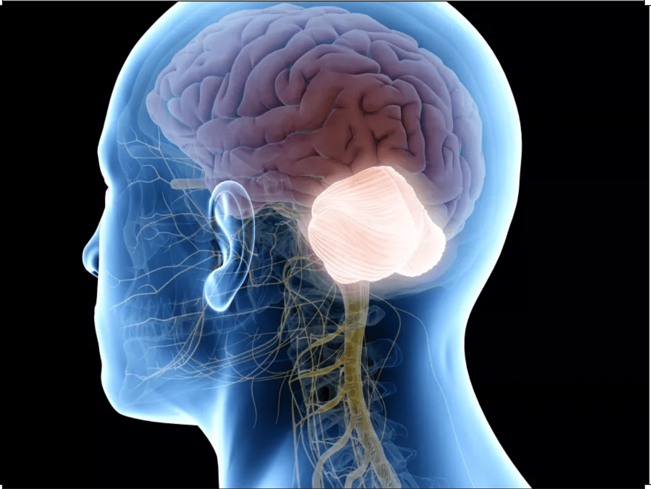 Syndrome cérébelleux :rééducation pour retrouver l’équilibre