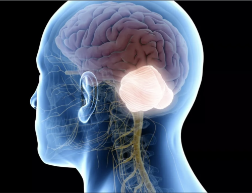 Syndrome cérébelleux :rééducation pour retrouver l’équilibre